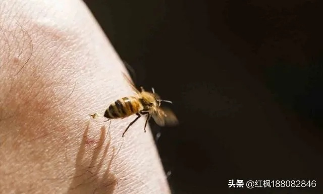 黄蜂蛰了最快消肿止疼，科学应急与家庭护理全攻略